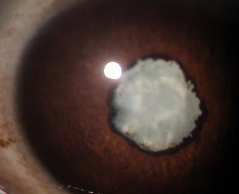 Close up image of the front of the eye