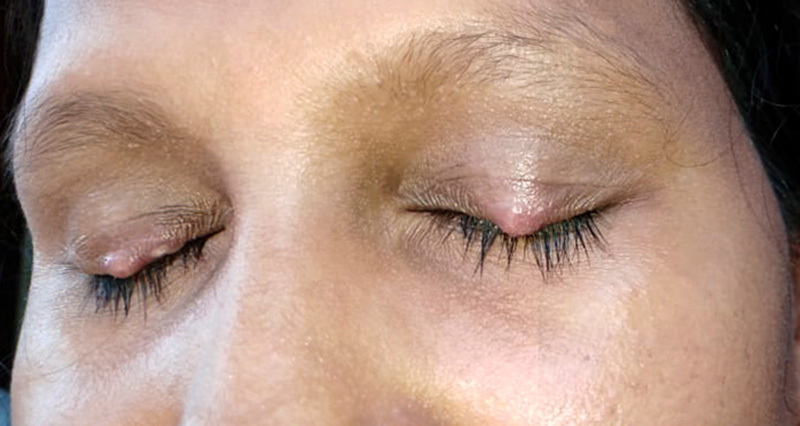Close up image of the eyes and nose